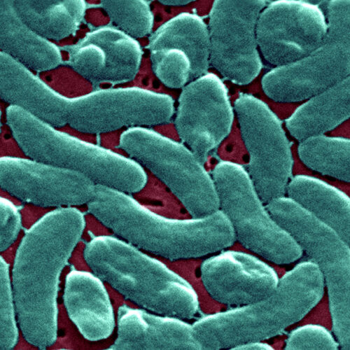 Flesh-eating bacteria devour man's arm and leg in just three days