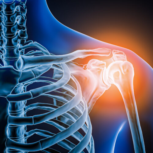 Doctors took a look at man's painful shoulder—they found the joint was missing