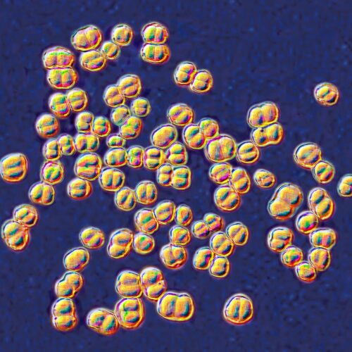 College lab class ends with 32 people on antibiotics for deadly germ exposure