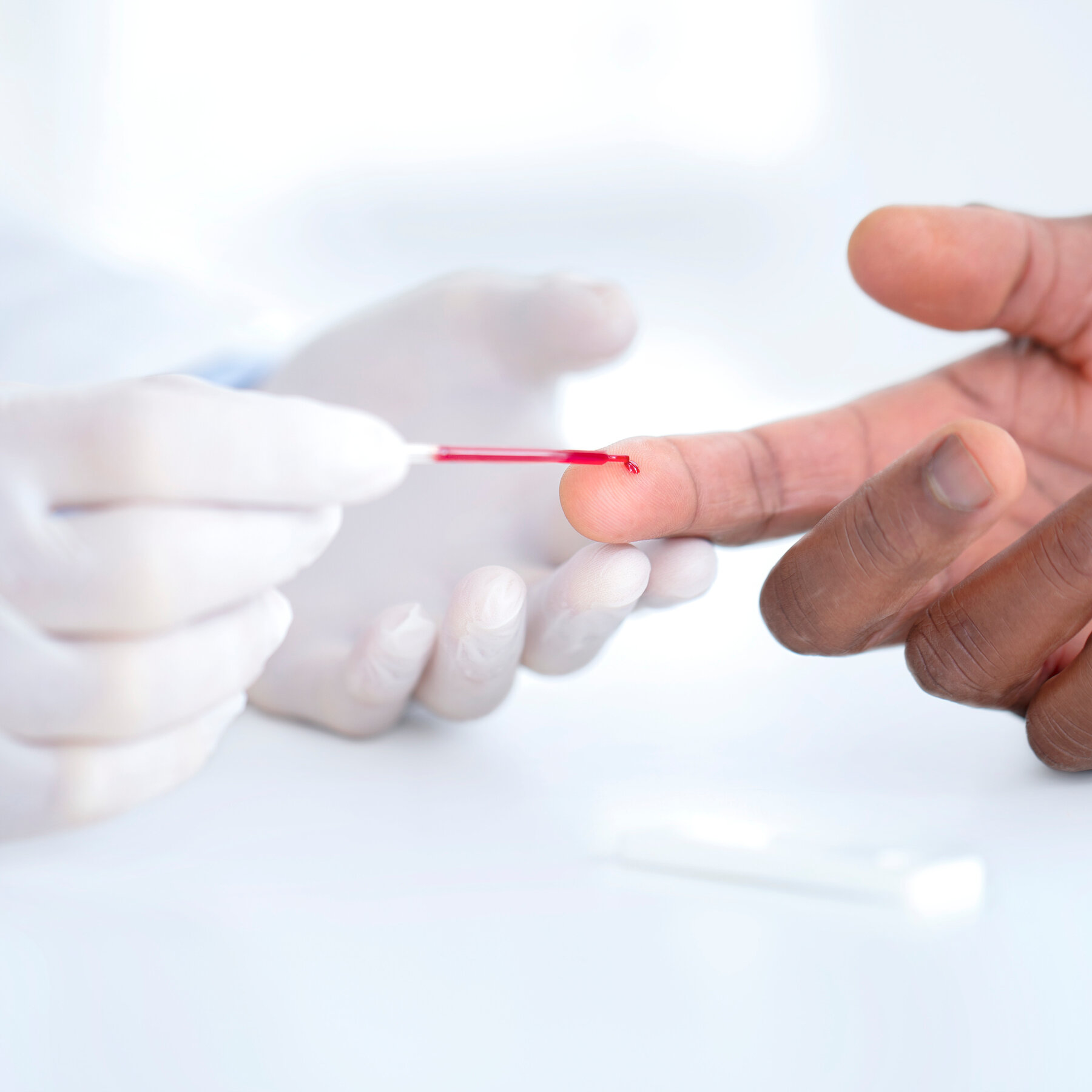 Earlier Cholesterol Testing Can Reduce Heart Attacks and Strokes, New Guideline Says