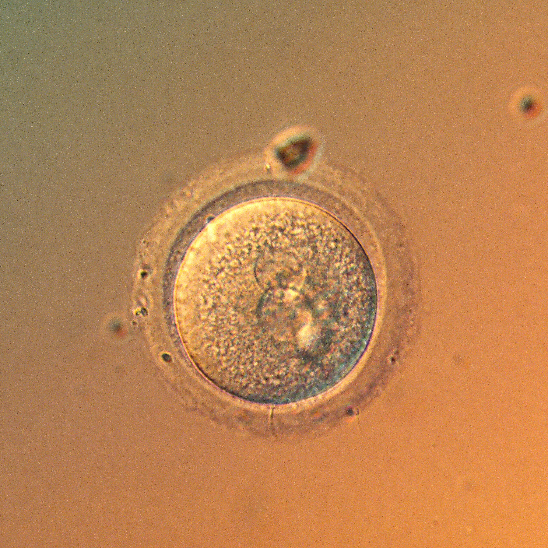 In a First, Scientists Precisely Edit Human Embryo Genes
