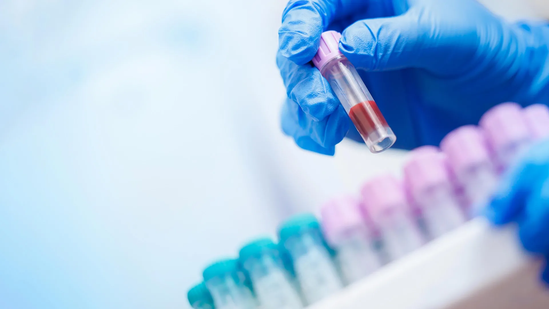 A simple blood test could reveal Alzheimer’s risk years early