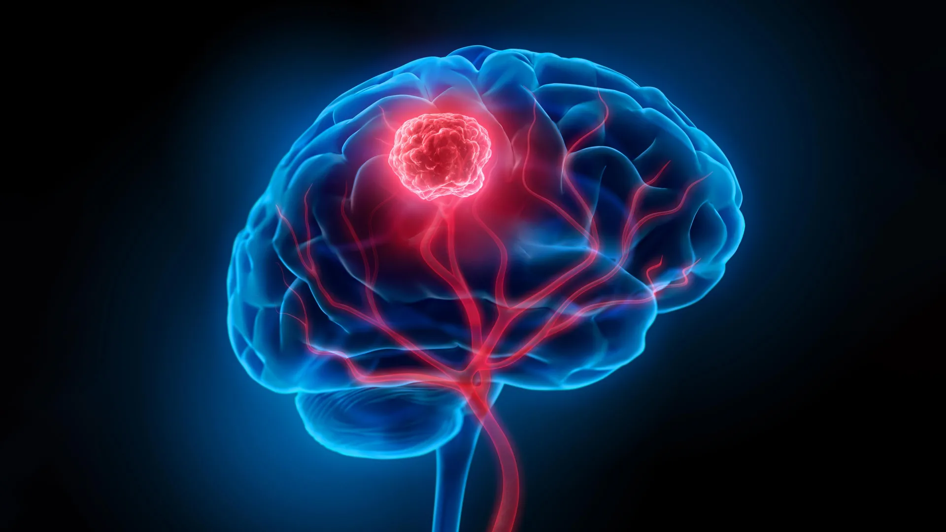This virus therapy supercharges the immune system against brain cancer