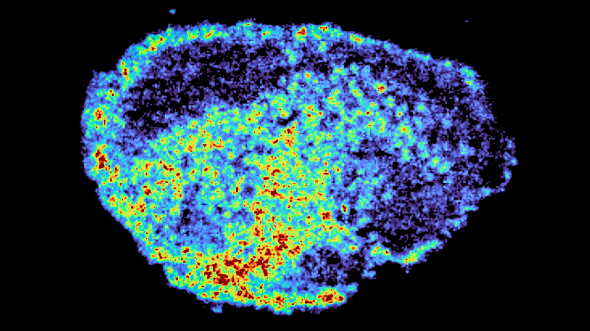 Scientists discover why cancer drugs don’t work for everyone