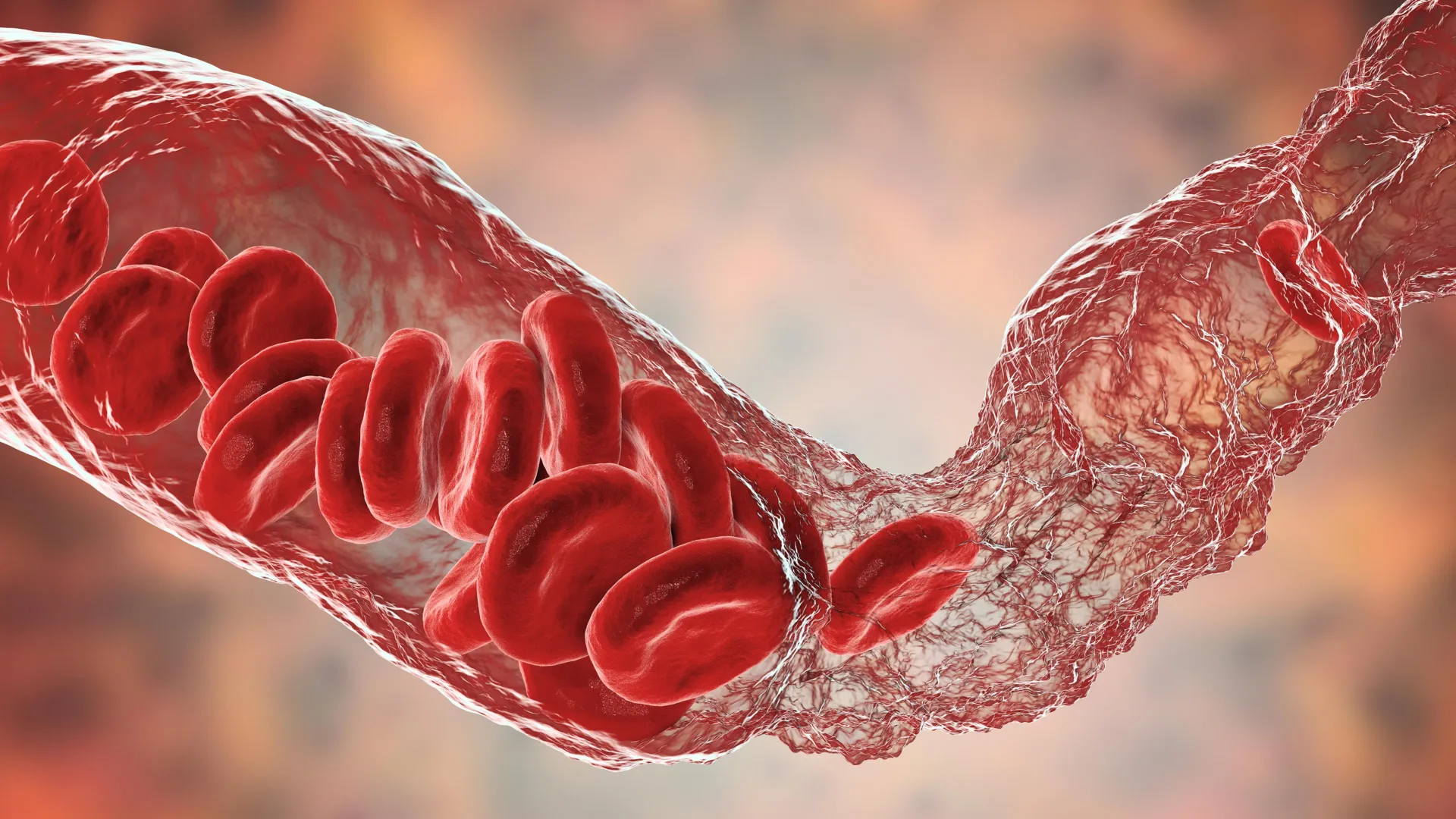 Scientists finally crack mystery of rare COVID vaccine blood clots