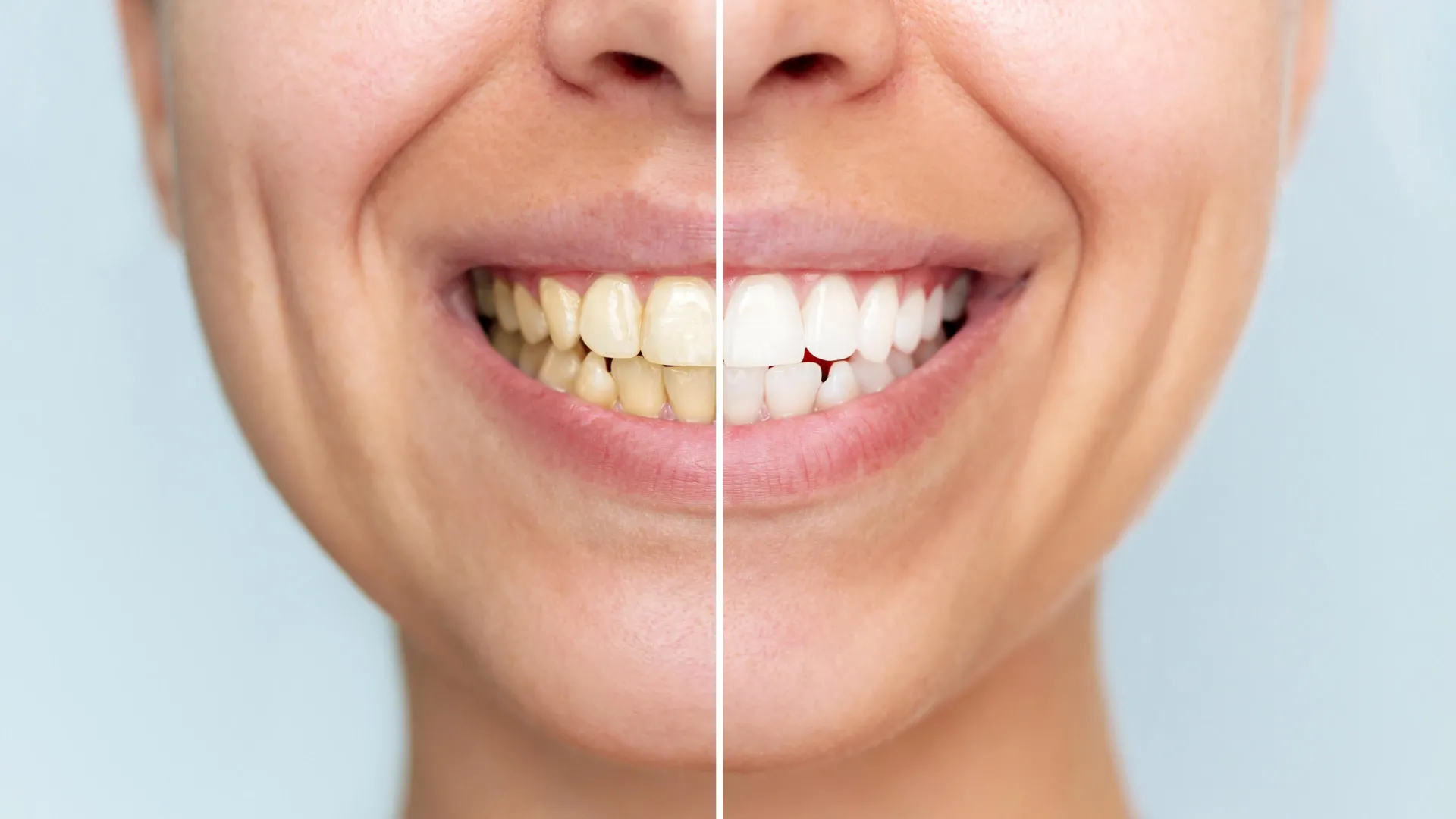 This new tooth powder whitens teeth without damage