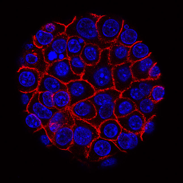 STAT+: Combination of pancreatic cancer drugs from Tango, Revolution leads to high response rate