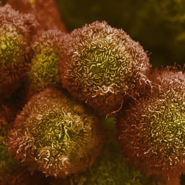 STAT+: Revolution Medicines touts ‘unprecedented’ data for pancreatic cancer pill