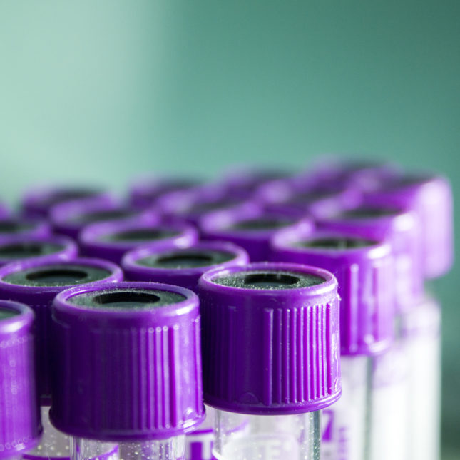 Opinion: Beware the unintended consequences of testosterone screening for military servicemembers