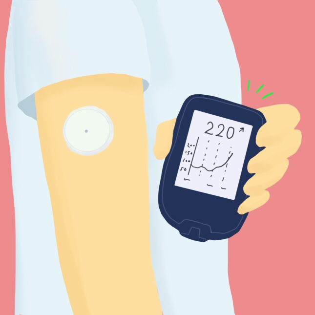 Dexcom RCT suggests CGM benefits for broad diabetes population