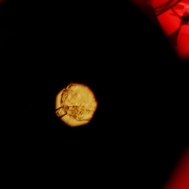 STAT+: Embryo editing advances reignite ethical debates