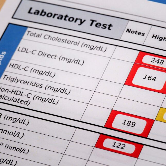 Major changes to cardiovascular guidelines suggest taking statins as young as 30