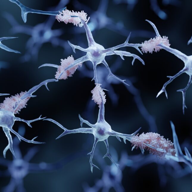 STAT+: Verge Labs’ new AI model solves patient stratification problems for neurology clinical trials