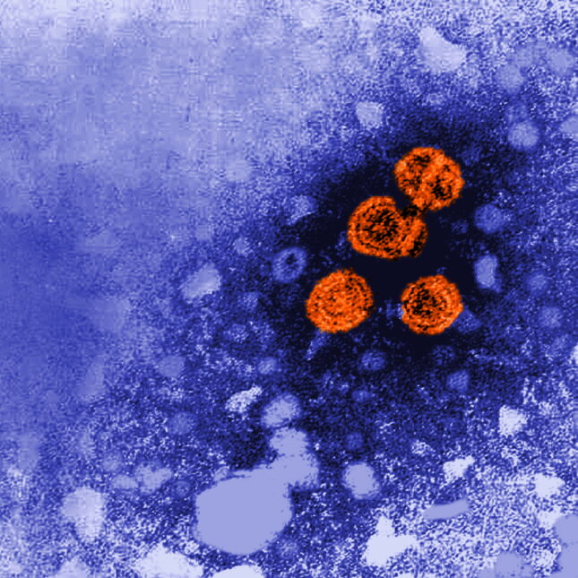 STAT+: Experimental hepatitis B treatment was a ‘functional cure’ for nearly 1 in 5, new data show