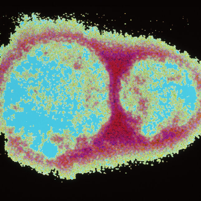 Opinion: I’m fighting misinformation online. False hantavirus claims follow a now-familiar playbook