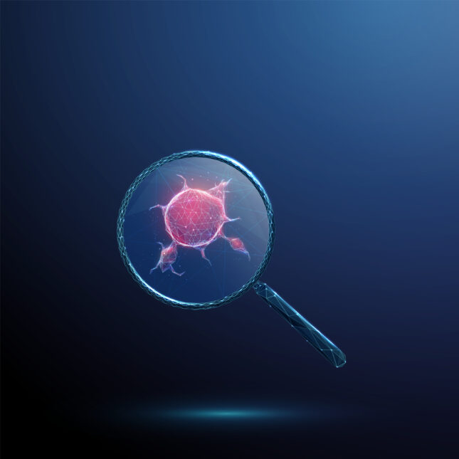 Opinion: STAT+: The real work for making dramatic gains against pancreatic cancer is just beginning