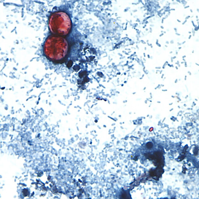 A new, separate outbreak of the diarrhea-causing parasite